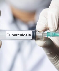 Tuberculosis