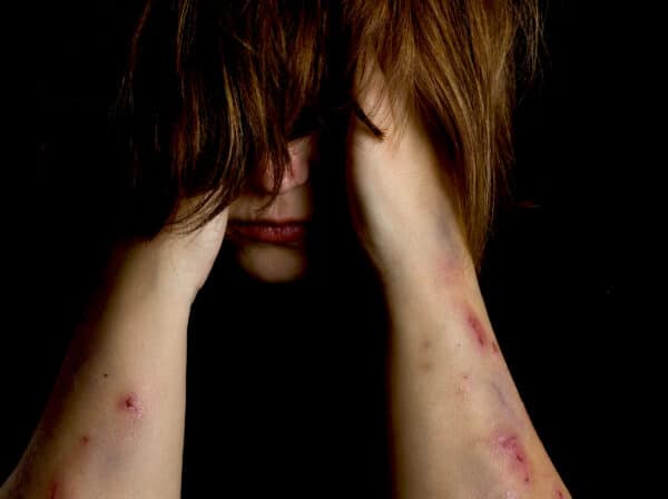 Self Harm