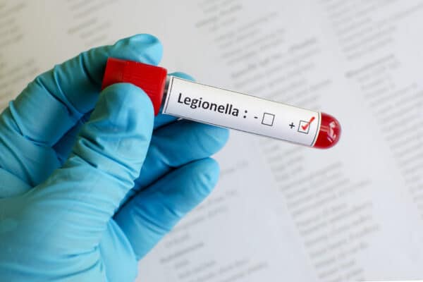 Legionella Disease